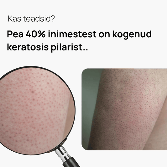 The KP Bump Eraser